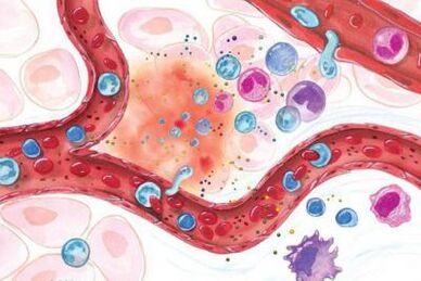 Boswellia mõju põletikulistele kehapiirkondadele